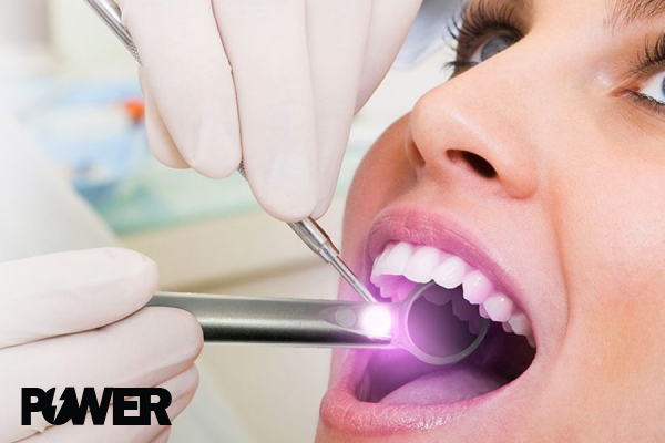 دستگاه جرم گیر دندان